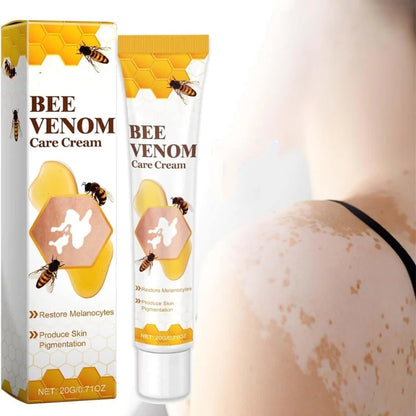 Bee Venom Vitiligo Treatment Cream | Skin Repair & Hydration (IMPORTED)