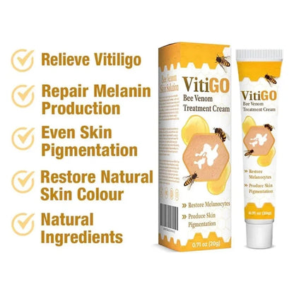 Bee Venom Vitiligo Treatment Cream | Skin Repair & Hydration (IMPORTED)