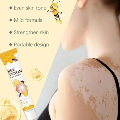 Bee Venom Vitiligo Treatment Cream | Skin Repair & Hydration (IMPORTED)